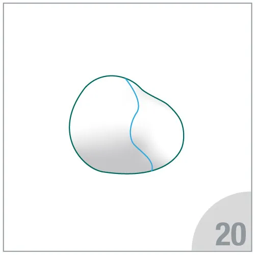 Schlinggazetupfer-Set, steril, à 20, 25x25cm, RK, OP, VM 20,  Peel/Peel